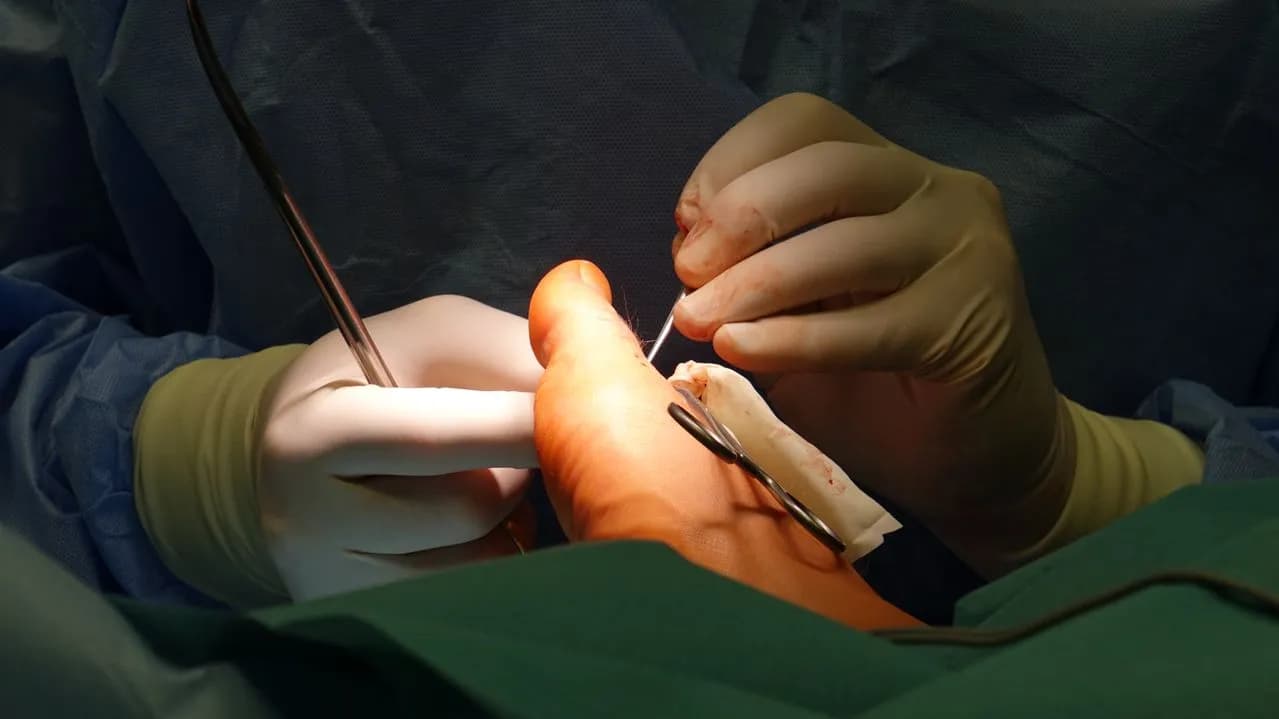 Diabetic Foot Care Clinics